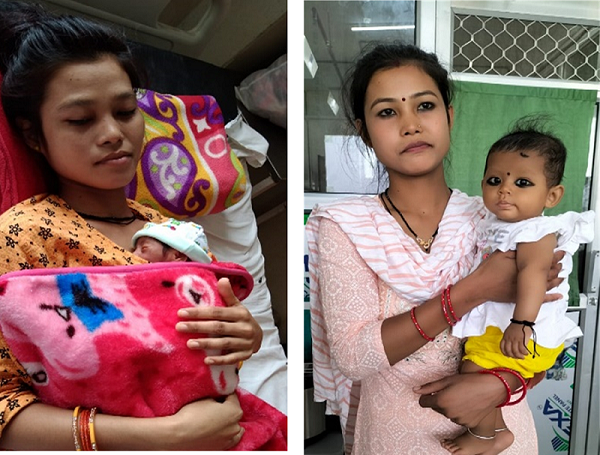 Rupa and Amit's baby girl, before and after intervention